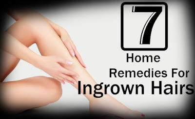 Natural Remedies