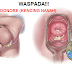 Kapsul obat tradisional mengatasi kencing nanah thumbnail