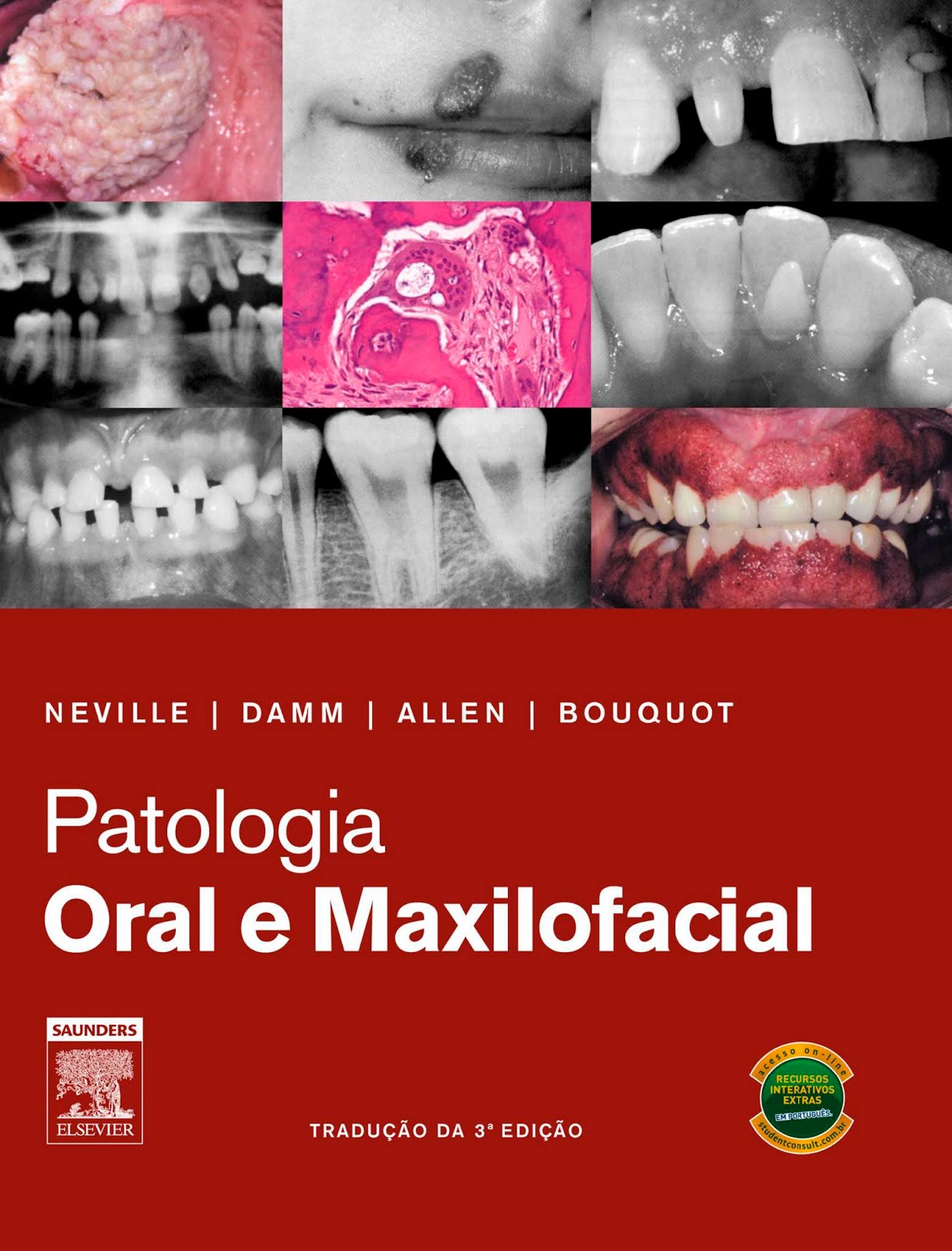 Livro Patologia Oral E Maxilofacial Neville 3°edição Dicas Anatomil