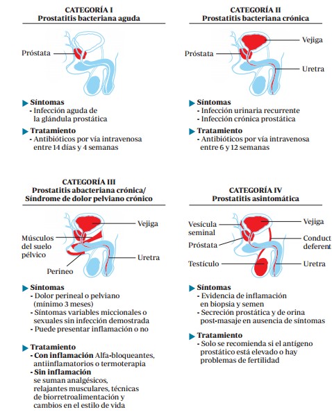 prostatitis d aguda o crónica
