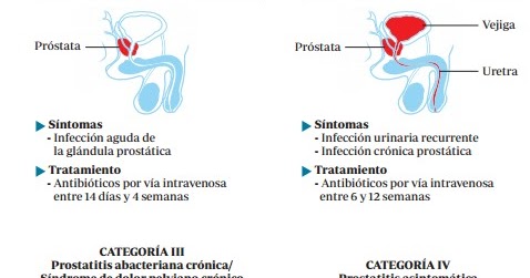 tipos de prostatitis aguda