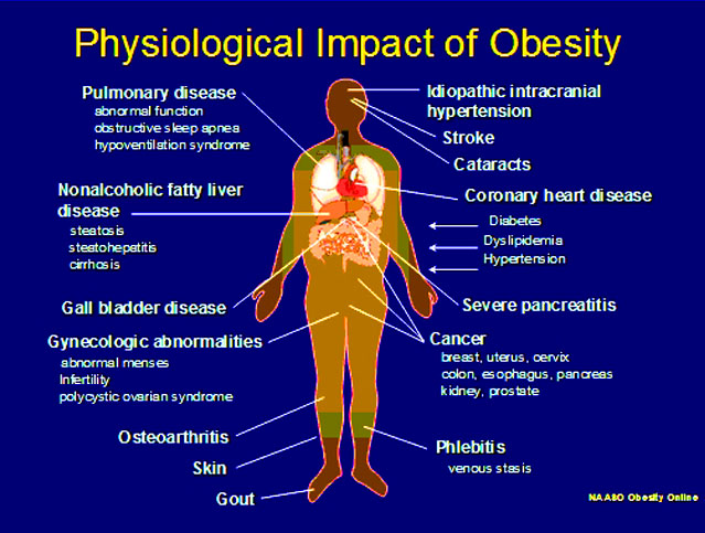 The Effects Of Obesity On Today s