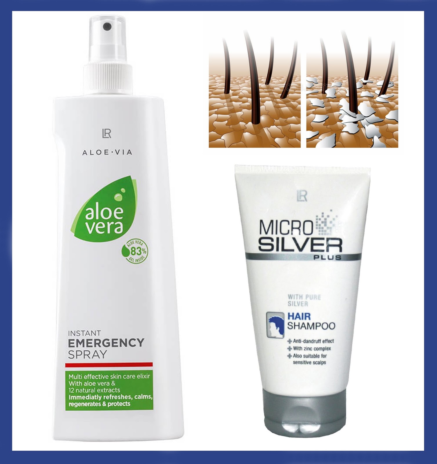 Aloe Vera Acil Yardim Spreyi 400 Ml