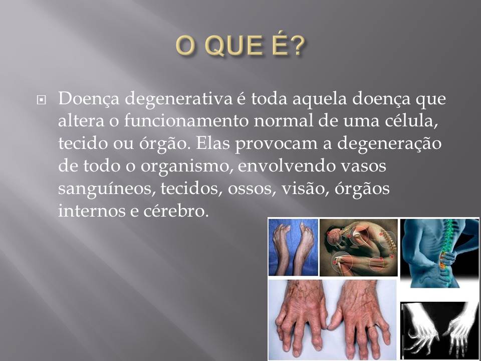JA Serviços Gráficos doenças degenerativas doenças neurodegenerativas trabalho de josé aldo