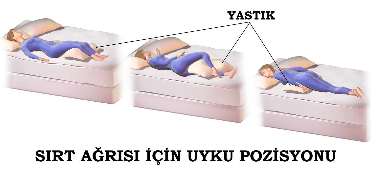 Sırta Vuran Ağrı Sırta Vuran Ağrı