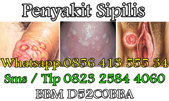 Obat Herbal Alami Buat Sipilis Obat Herbal Alami Buat Sipilis