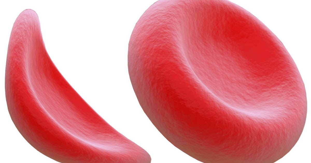 Endari Cost, Side effects, Dosage, Uses for sickle cell disease
