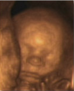 Hafta hafta bebeğin ultrason görüntüleri-21.hafta