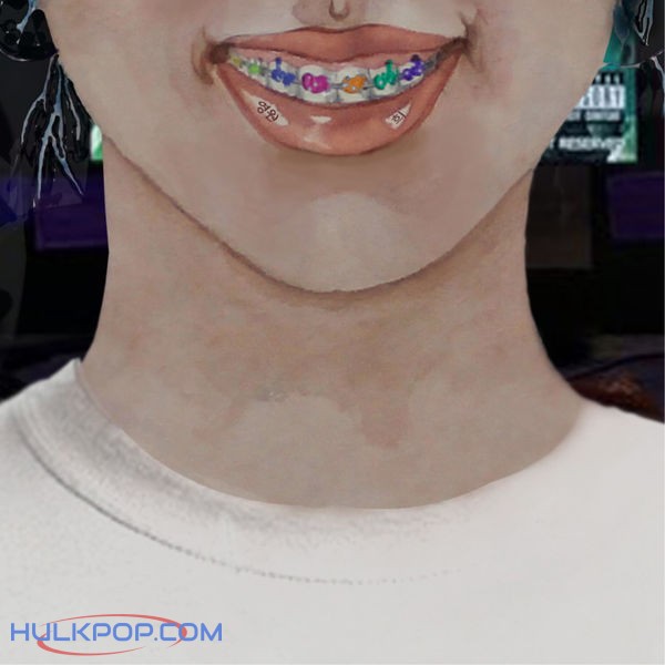 Chae Won Heui – Thorn – Single