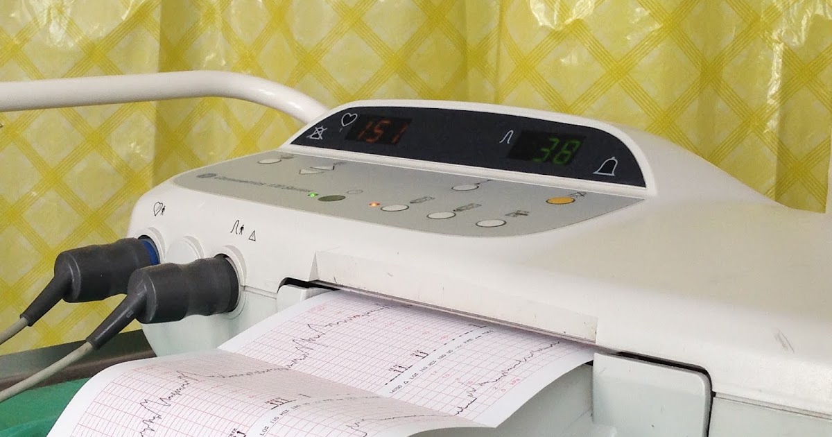 Niesforna Zuzia Zapis KTG co to takiego i po co się go robi?