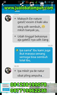 Obat Penyakit Gatal Selangkangan Parah Menahun Obat Penyakit Gatal Selangkangan Parah Menahun