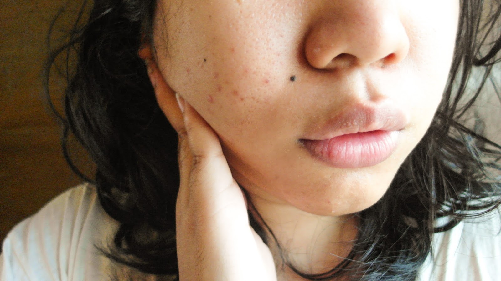 Review Nyobain Treatment Acne Facial Bio Light Therapy Dari Naava Green Duckofyork Indonesian Lifestyle Blogger