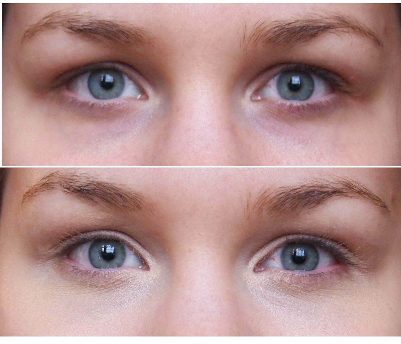 perricone md concealer