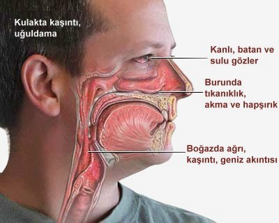 Kulak Kasintisi Neden Olur Kulak Icerisinde Baslayan Kasinti Hangi Hastaligin Habercisidir Saglik Haberleri