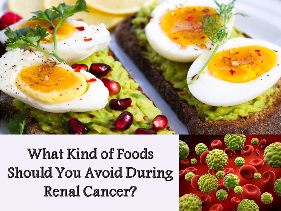 what not to eat when you have kidney cancer