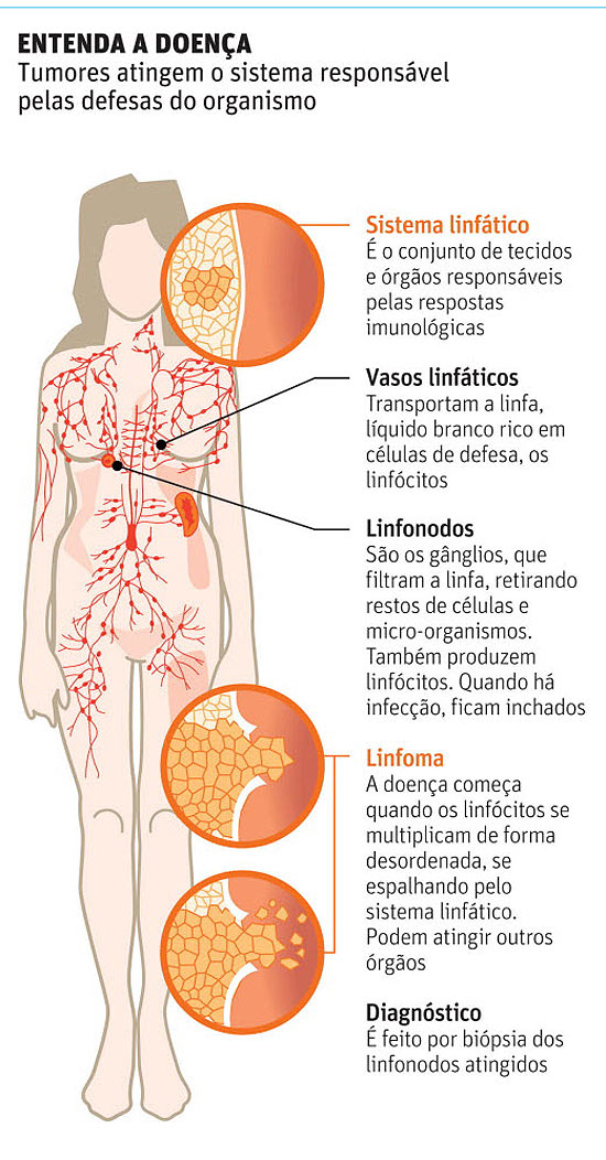 linfonodos aumentados virilha