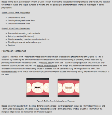 Stu-DENT Diaries: Class I Cavity Preparation