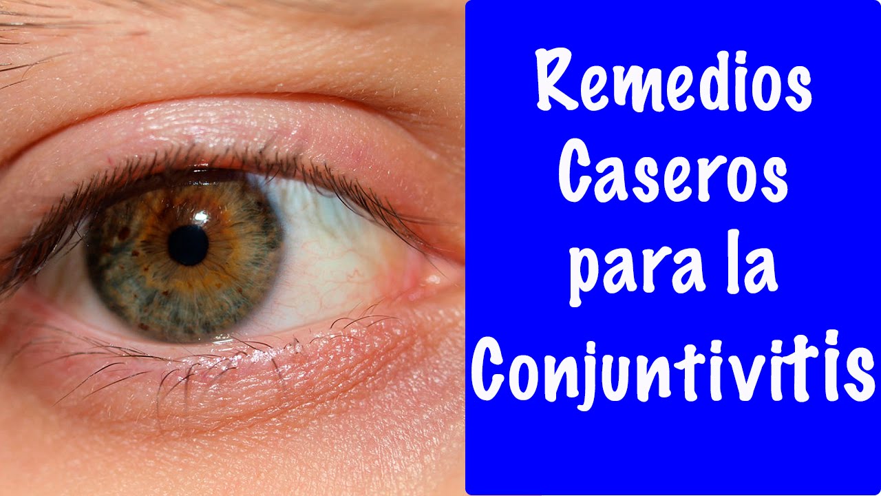 remedios para la conjuntivitis en adultos