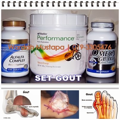 Anda Gout?Cubalah yang semulajadi