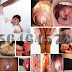 Terapi Pengobatan Non Medis Penderita Gonore thumbnail