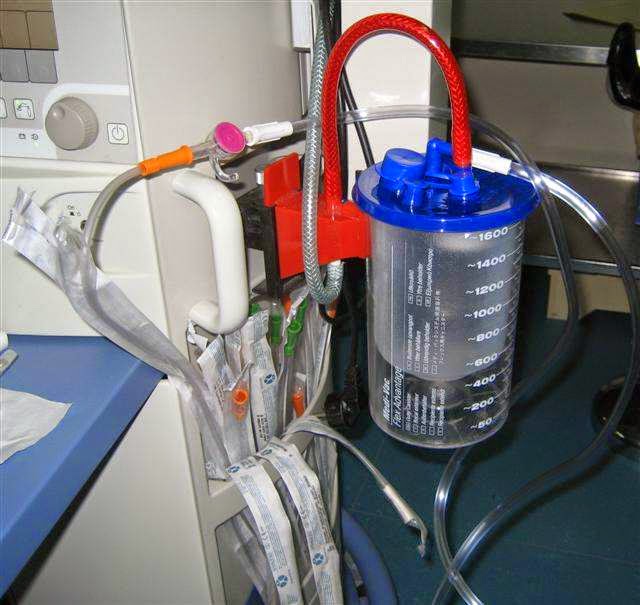 L'aspiration trachéobronchique Récap' IDE