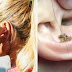 Doctors Warn: Wearing Headphones Too Long Could Cause Blackheads In Ear
