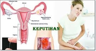 Foto Obat Herbal penyebab vagina keputihan berbau menyengat