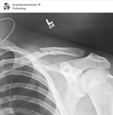 2aa Watch Brooklyn Beckham break his collarbone in snowboarding incident