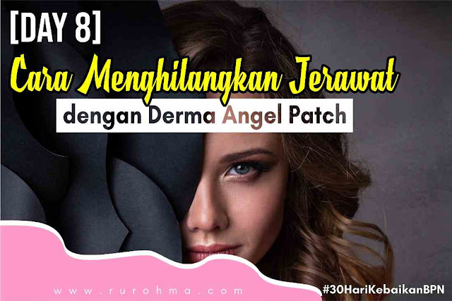 Cara Menghilangkan Jerawat Cara Menghilangkan Jerawat