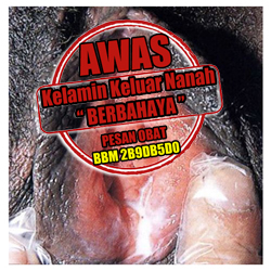 Pengobatan Wanita Gonore (Kencing Nanah) Pengobatan Wanita Gonore (Kencing Nanah)
