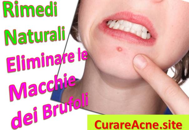 Come togliere le macchie. come togliere le macchie dal divano with ... Come togliere le macchie di ruggine