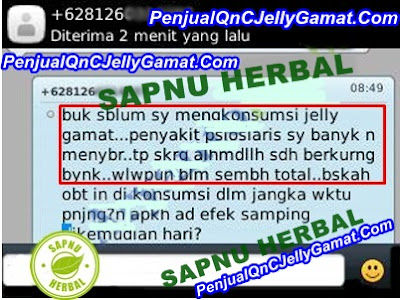 Cara Mengobati Gatal Biduran Secara Alami Sampai Tuntas Cara Mengobati Gatal Biduran Secara Alami Sampai Tuntas