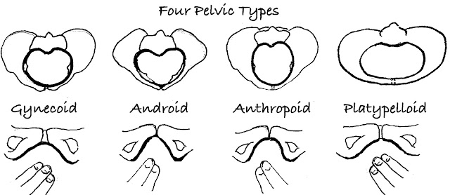 Spinning Babies "Help me! I'm recently diagnosed with an android pelvis and have had 2 cesareans. Now I'm desperate for a VBAC for this third baby," was the comment on pelvic shape elsewhere in this blog.