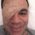 Mauro Beting sofre deslocamento de retina e se afasta do trabalho na Jovem Pan e Esporte Interativo