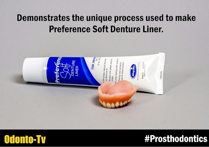 PROSTHODONTICS: Preference Soft Denture Liner Process - Whip Mix