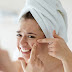 4 Tips on How to Treat Adult Acne 4 Tips on How to Treat Adult Acne