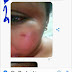 Man Brutalizes His Pregnant Wife Ahead Of Valentine's Day Over Gambling - Graphic Photos