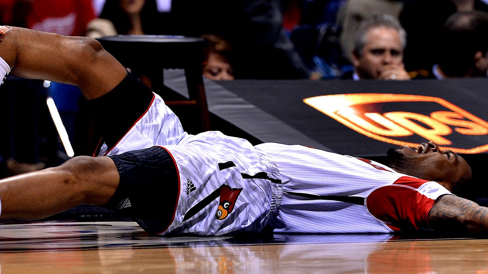 серьезный перелом. серьезный перелом. серьезный перелом. открытые переломы в спорте. серьезный перелом.