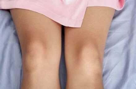 Cara Memutihkan Siku dan Lutut
