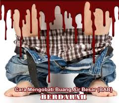 Foto cara mudah menghilangkan benjolan wasir luar secara alami di malasia