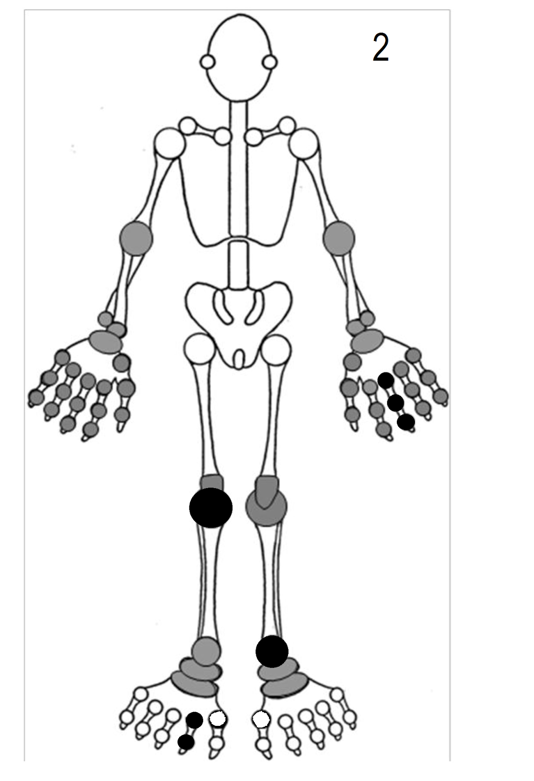 Rheumatology pain diagram body pain diagram organs rheumatology pain diagram body pain diagram organs