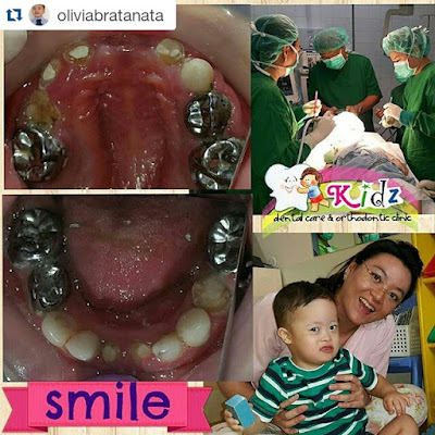 Perawatan Gigi dengan Bius Umum