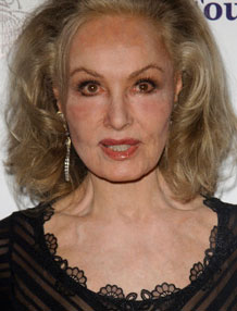 Julie Newmar Plastic Surgery Before and After Facelift Photos | Plastic ...