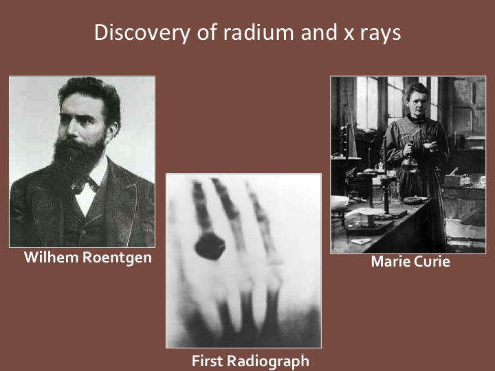 cancerradiotherapyinfo The journey from radium to SBRT (Part 1)