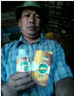 Ciri-Ciri Usus Buntu Dan Cara Mengobatinya