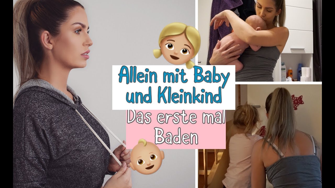 nabelbruch baby Germany News Collections