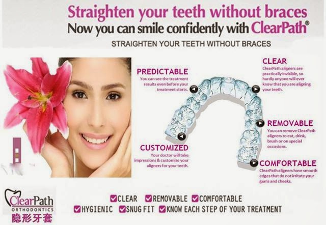 Clearpath braces