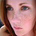 Remove Dark Spot Challenge in 2 weeks only