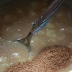 CLEAN YOUR BODY FROM PARASITES AND RETURN TO YOUR NORMAL WEIGHT WITH THESE 2 INGREDIENTS THAT YOU ALWAYS HAVE IN YOUR HOUSE!