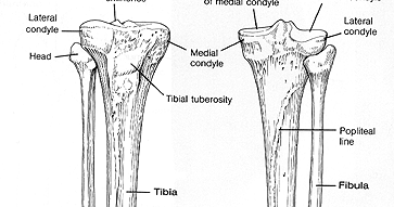 Radiology (kawasan radiasi): Fraktur Cruris Pada Tibia-Fibula